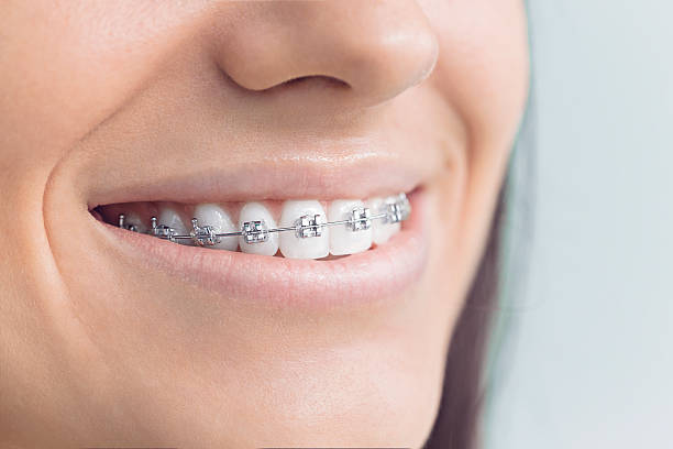 Best Invisalign and Clear Aligners  in Keedysville, MD
